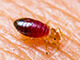 A bed bug crawling on human skin.