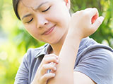 A young woman scratching her arm outside from a mosquito bite.